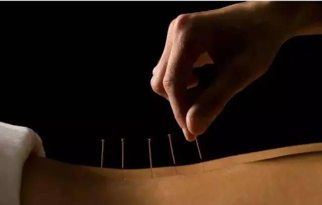 平衡針灸最新視頻，現(xiàn)代應用探索針灸藝術的新境界