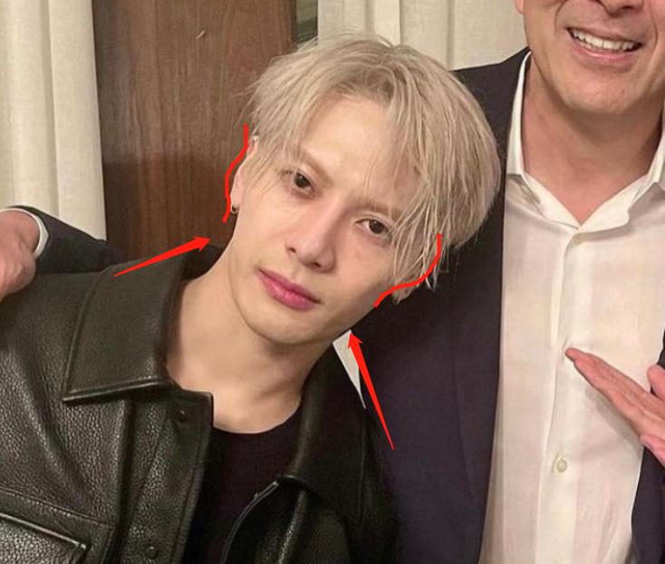 深度解析明星整容后遺癥，觀點與影響探討