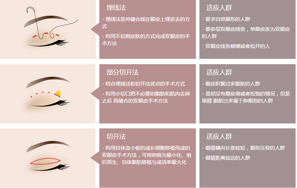 眼部整形最新技術(shù)揭秘