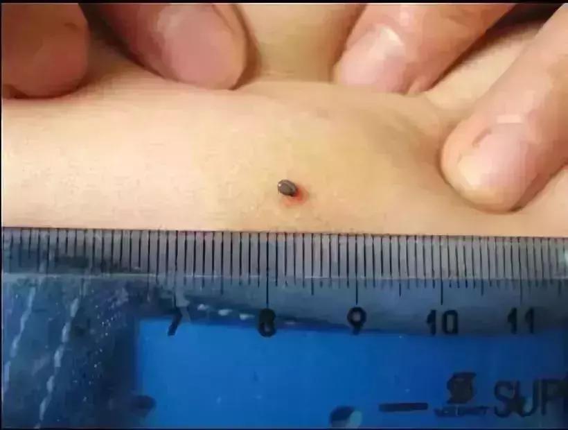 小明快樂疫情日志，最新疫情發(fā)布與日常觀察