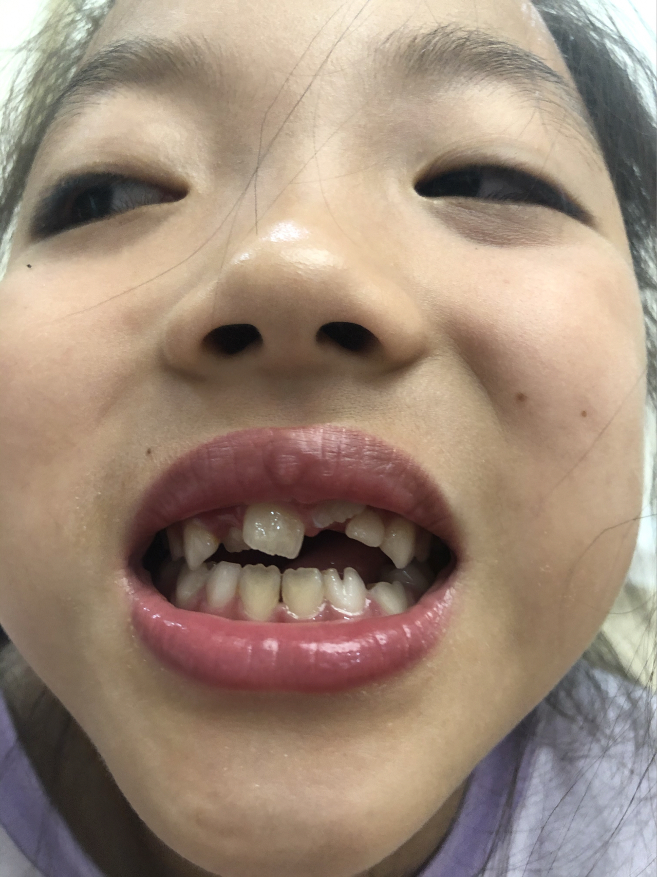 莊最新牙齒技術(shù)揭秘，牙齒美容新選擇